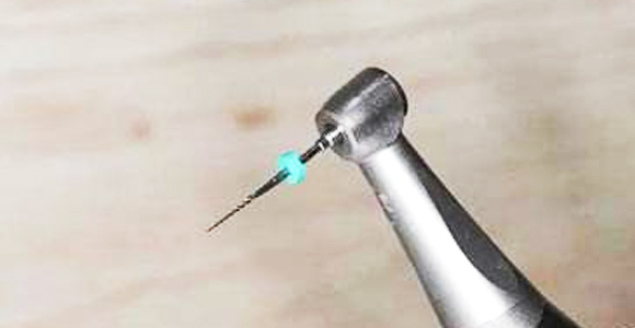 精細切割，極大程度保留牙神經(jīng)，根管治療成功率極高