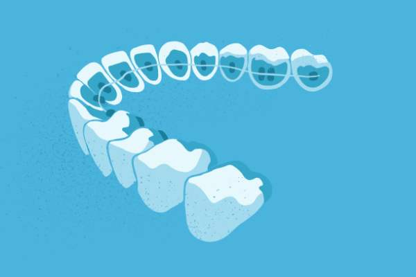 惟德口腔醫(yī)院口腔正畸好不好？