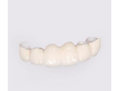 請(qǐng)問承德做一顆全瓷牙價(jià)位是多少